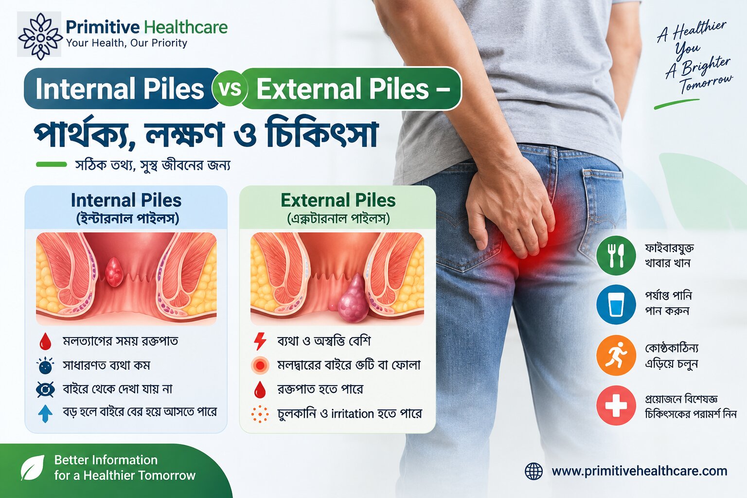Internal Piles vs External Piles